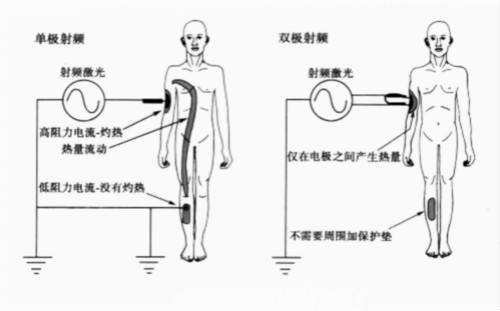 射频美容仪,美容院美容设备,家用美容仪