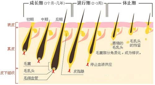 激光脱毛,808半导休脱毛机,永久脱毛,无痛脱毛