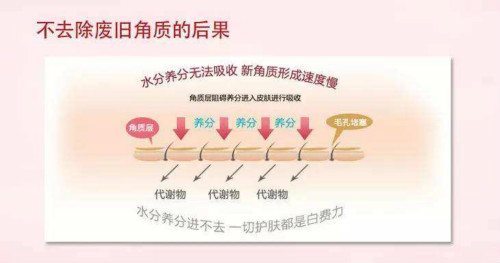 祛角质,洁面仪,去油脂,洁面仪器