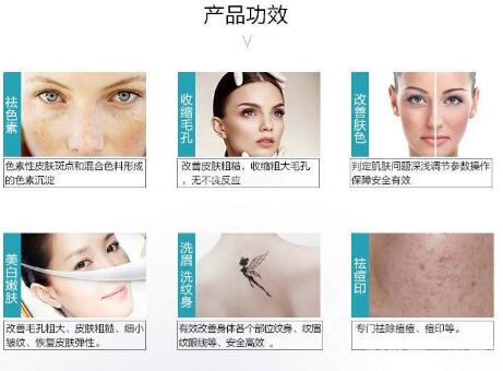 皮秒激光祛斑,775蜂巢皮秒激光祛斑仪,激光美容仪器,皮秒激光祛斑感觉