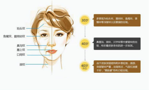 美容该仪器除皱,美容仪器安全吗,无创美容仪器,无痛美容仪器 美容该仪器除皱,美容仪器安全吗,无创美容仪器,无痛美容仪器