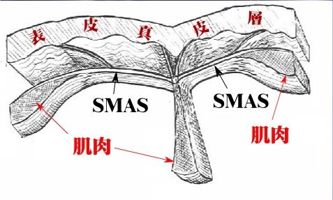 SMAS筋膜层