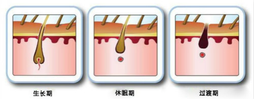 激光脱毛一次多少钱？能维持多久？