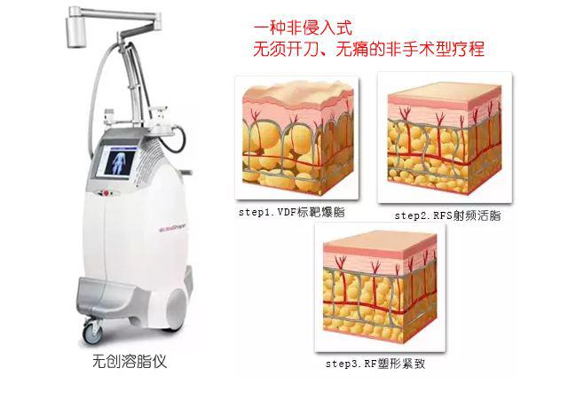 用核磁仪器爆脂减肥?只是一个噱头而已 用核磁仪器爆脂减肥?只是一个噱头而已