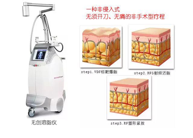 用核磁仪器爆脂减肥？只是一个噱头而已