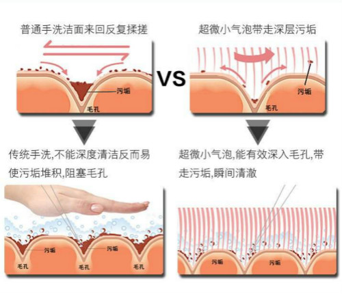 韩国超微小气泡原理