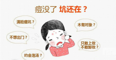 激光去痘印方法你适合吗？