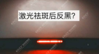 激光祛斑之后皮肤会反黑？美容仪器厂家教你这样预防