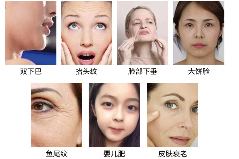 美容仪厂家教您怎么预防脸上长斑，要注意什么?