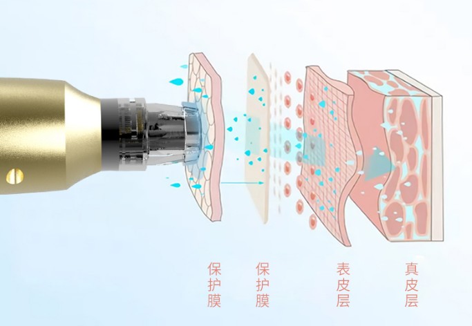 射频美容仪器提拉紧致真的有效吗