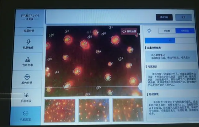 皮肤检测仪对于美容院来说有哪些作用？